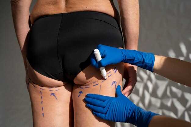 The truth about using filler in bodywork